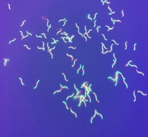 Fluorescent fibres revealed by UV light